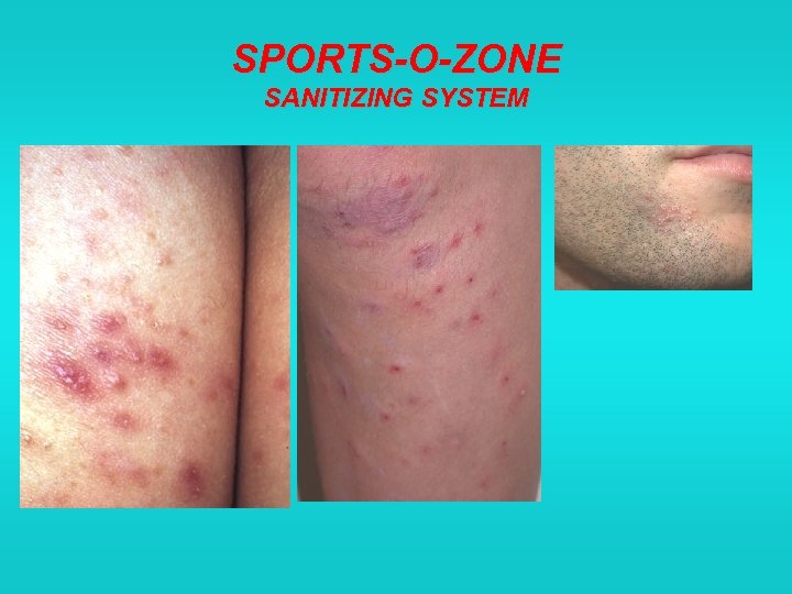 SPORTS-O-ZONE SANITIZING SYSTEM 