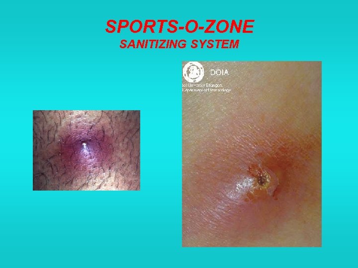 SPORTS-O-ZONE SANITIZING SYSTEM 