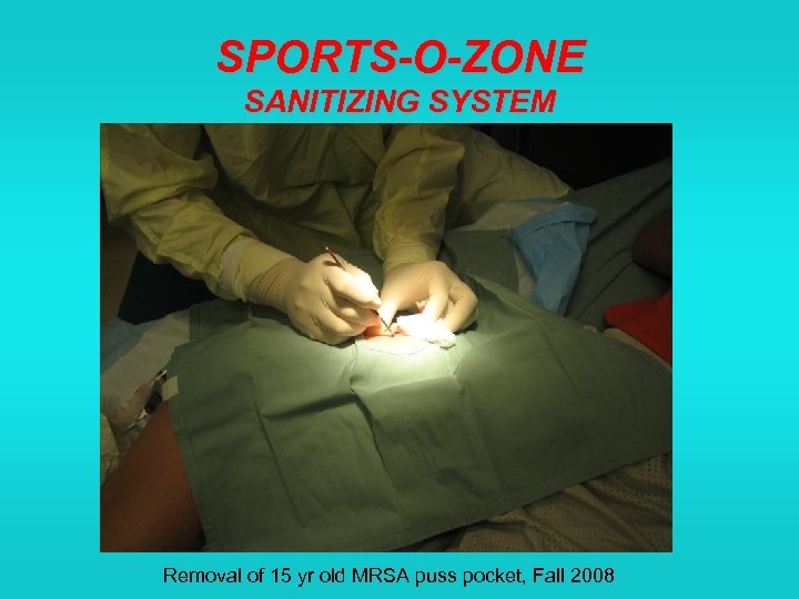 SPORTS-O-ZONE SANITIZING SYSTEM Removal of 15 yr old MRSA puss pocket, Fall 2008 