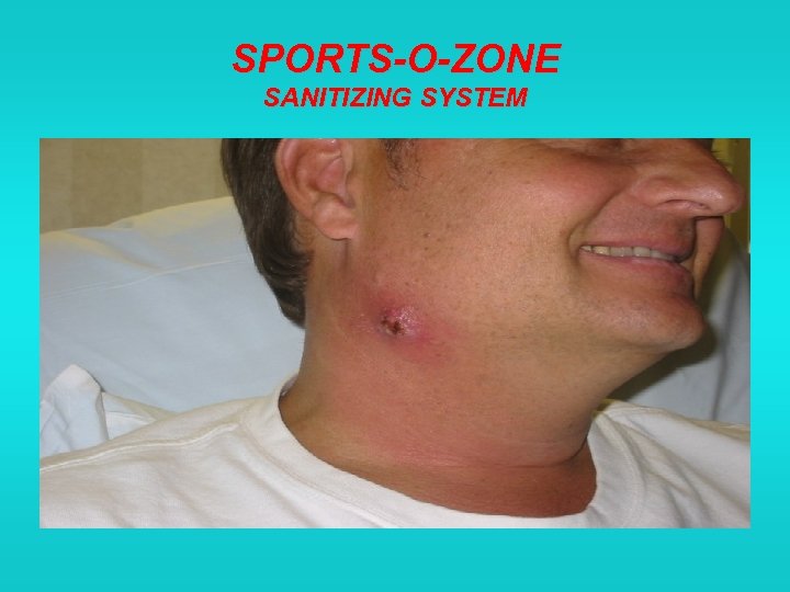 SPORTS-O-ZONE SANITIZING SYSTEM 