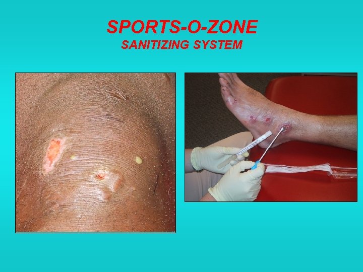 SPORTS-O-ZONE SANITIZING SYSTEM 