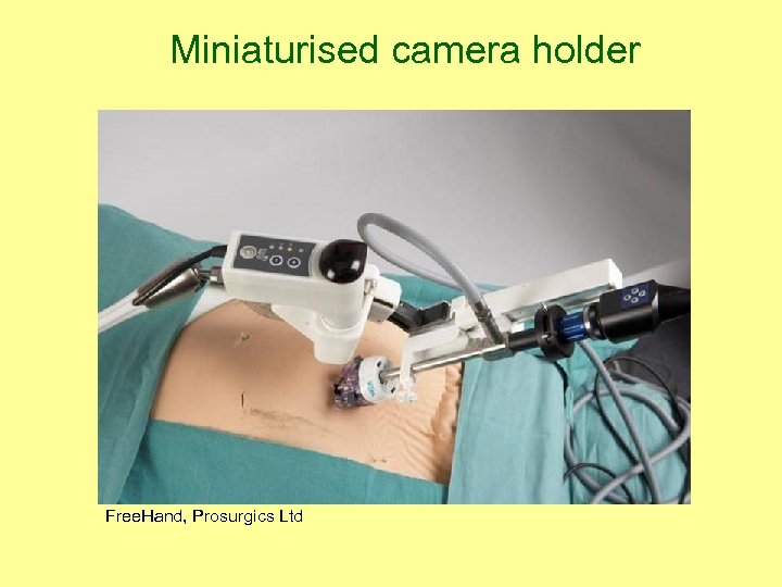 Miniaturised camera holder Free. Hand, Prosurgics Ltd 