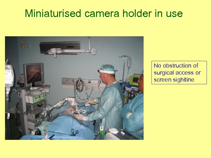 Miniaturised camera holder in use No obstruction of surgical access or screen sightline 