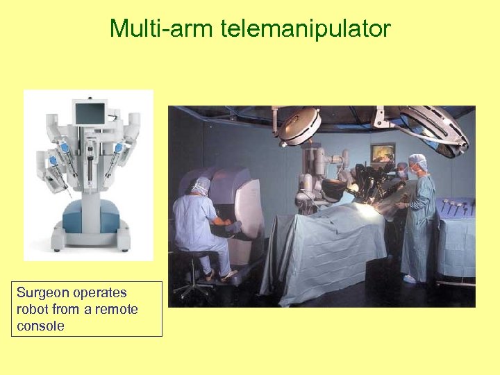 Multi-arm telemanipulator Surgeon operates robot from a remote console 