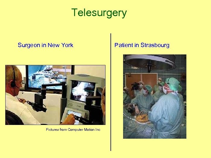 Telesurgery Surgeon in New York Patient in Strasbourg Pictures from Computer Motion Inc 