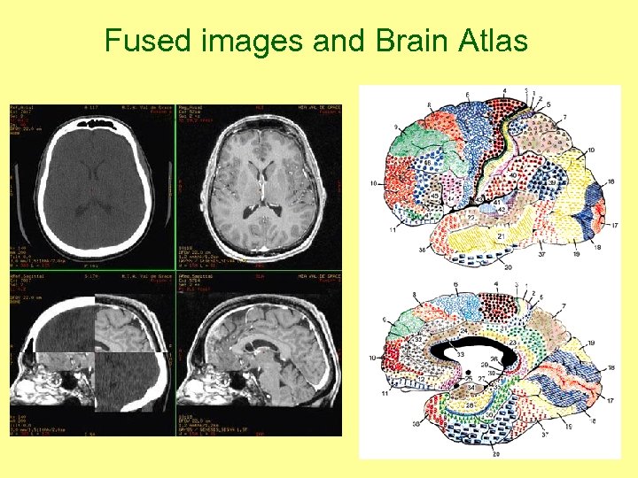 Fused images and Brain Atlas 