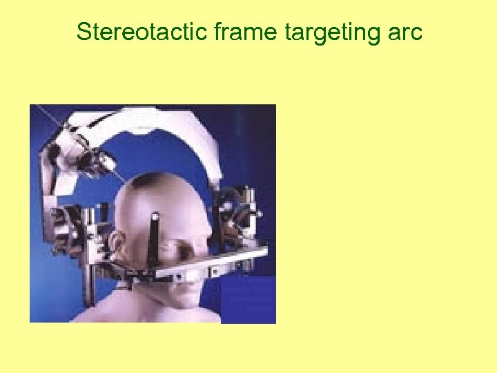 Stereotactic frame targeting arc 