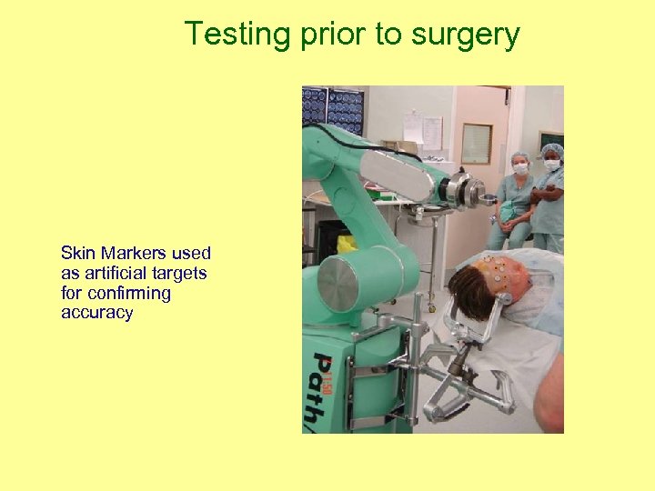 Testing prior to surgery Skin Markers used as artificial targets for confirming accuracy 