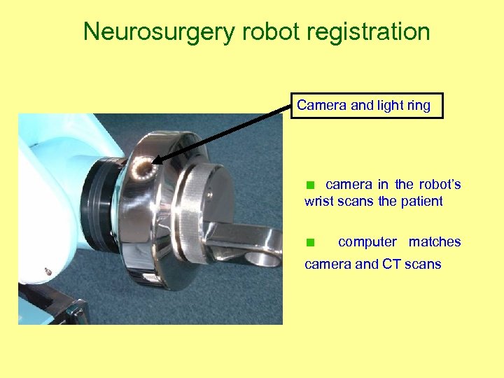 Neurosurgery robot registration Camera and light ring camera in the robot’s wrist scans the