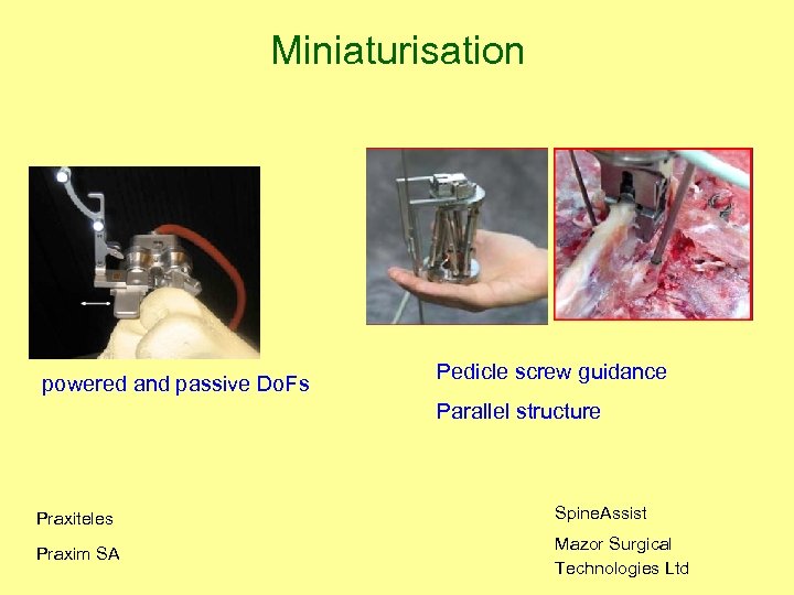 Miniaturisation powered and passive Do. Fs Pedicle screw guidance Parallel structure Praxiteles Spine. Assist