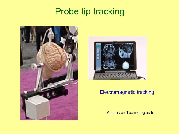 Probe tip tracking Electromagnetic tracking Ascension Technologies Inc 