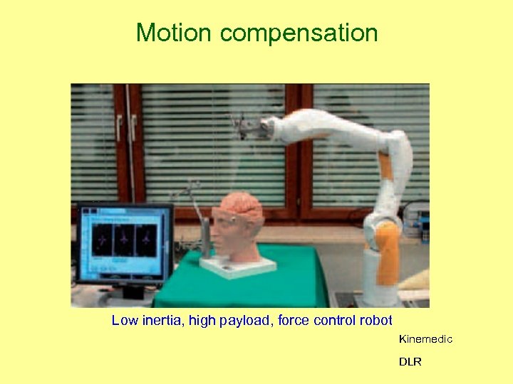 Motion compensation Low inertia, high payload, force control robot Kinemedic DLR 