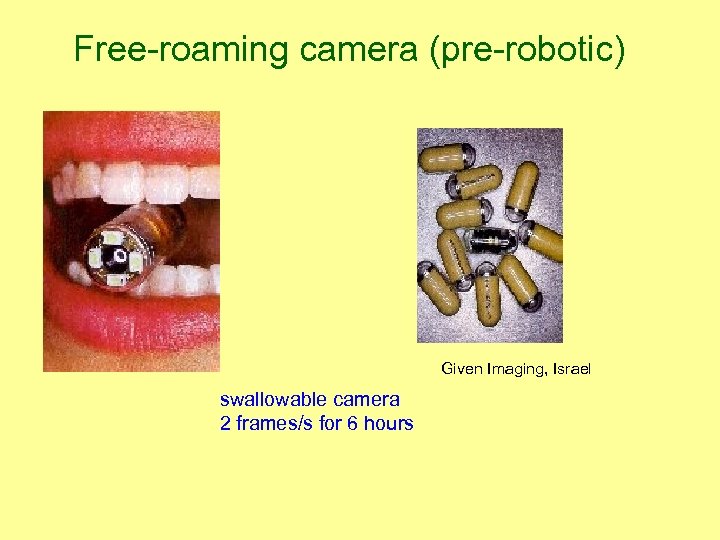 Free-roaming camera (pre-robotic) Given Imaging, Israel swallowable camera 2 frames/s for 6 hours 