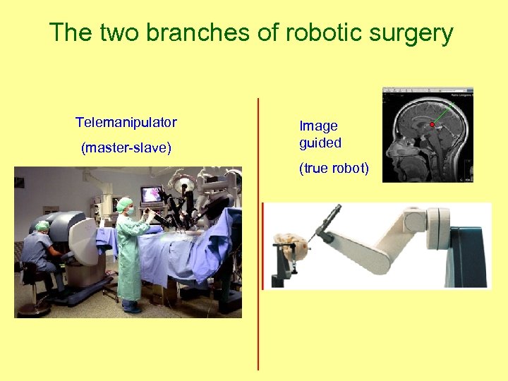 The two branches of robotic surgery Telemanipulator (master-slave) Image guided (true robot) 