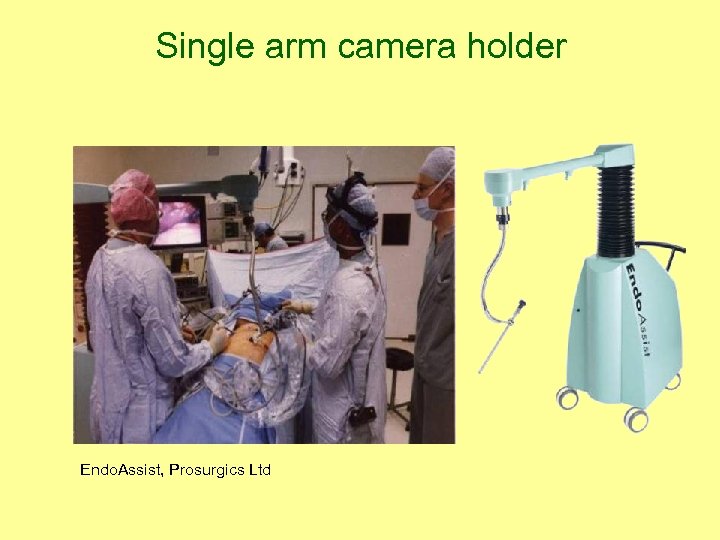 Single arm camera holder Endo. Assist, Prosurgics Ltd 