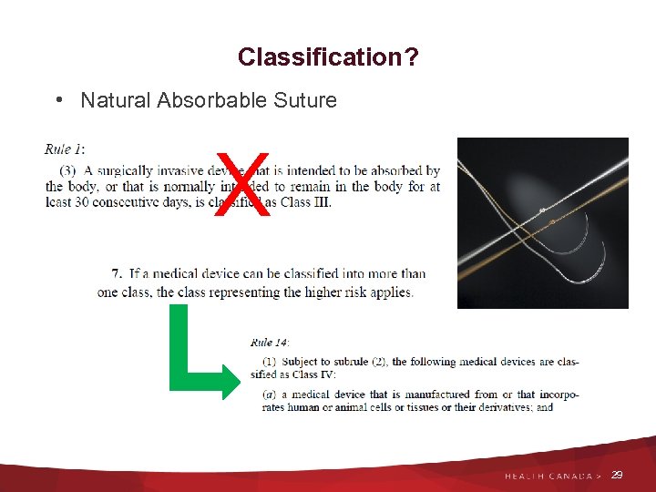 Classification? • Natural Absorbable Suture X 29 