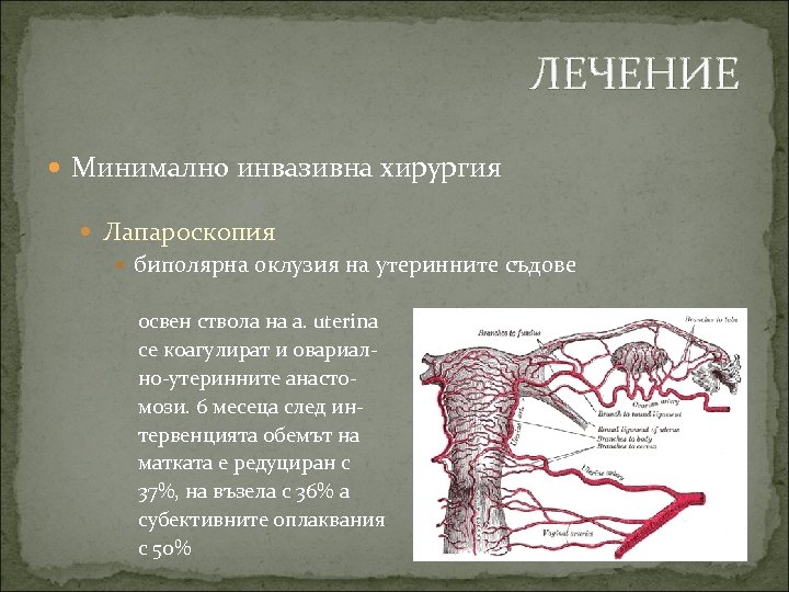 ЛЕЧЕНИЕ Минимално инвазивна хирургия Лапароскопия биполярна оклузия на утеринните съдове освен ствола на a.