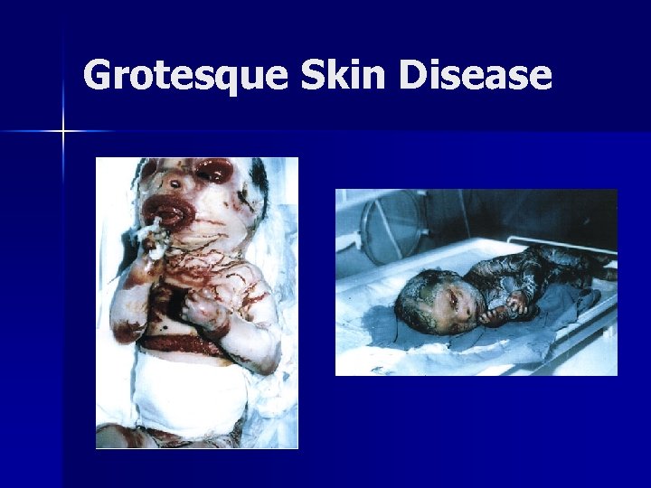 Grotesque Skin Disease 