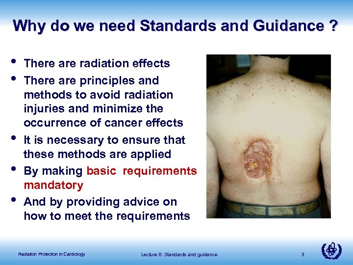 Why do we need Standards and Guidance ? • • • There are radiation