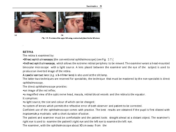 Examination 29 (a) (b). Fig. 2. 6 Eversion of the upper lid using a