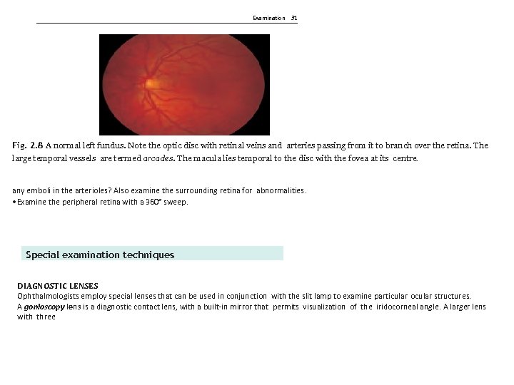 Examination 31 Fig. 2. 8 A normal left fundus. Note the optic disc with