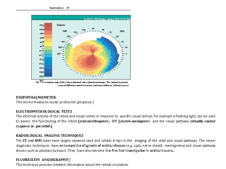 Examination 33 EYESYS CORNEAL ANALYSIS SYSTEM 42. 7 Dioptres 42. 3 TMP 42. 1