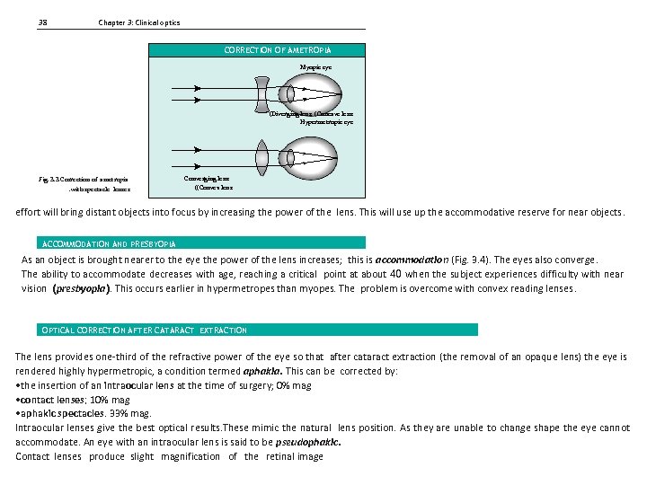 38 Chapter 3: Clinical optics CORRECTION OF AMETROPIA Myopic eye (Diverging lens (Concave lens