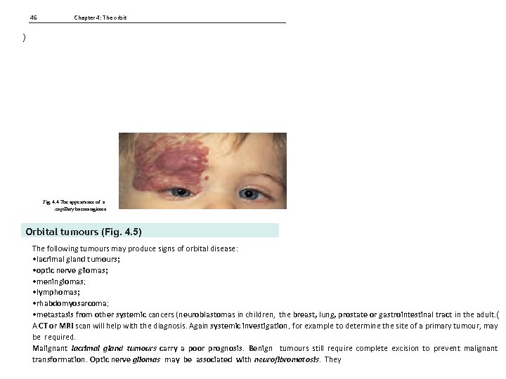 46 Chapter 4: The orbit ) Fig. 4. 4 The appearance of a. capillary