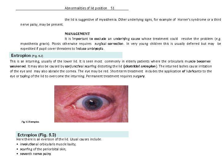 Abnormalities of lid position 51 the lid is suggestive of myasthenia. Other underlying signs,