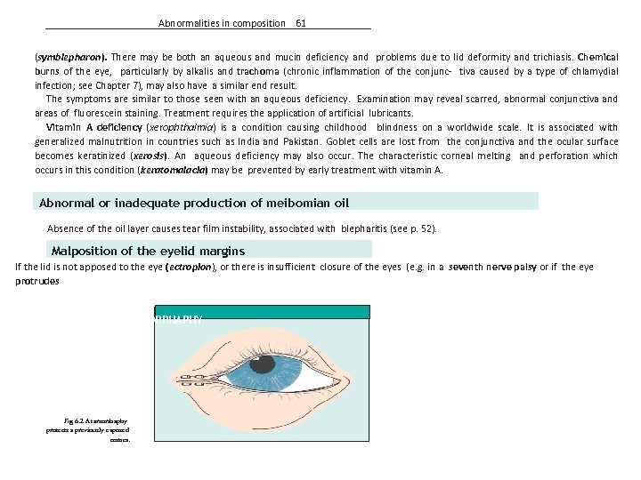 Abnormalities in composition 61 (symblepharon). There may be both an aqueous and mucin deficiency