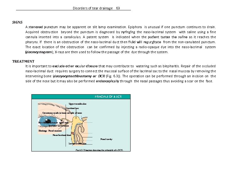 Disorders of tear drainage 63 SIGNS A stenosed punctum may be apparent on slit