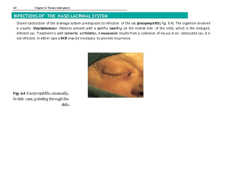 64 Chapter 6: The lacrimal system INFECTIONS OF THE NASO-LACRIMAL SYSTEM Closed obstruction of