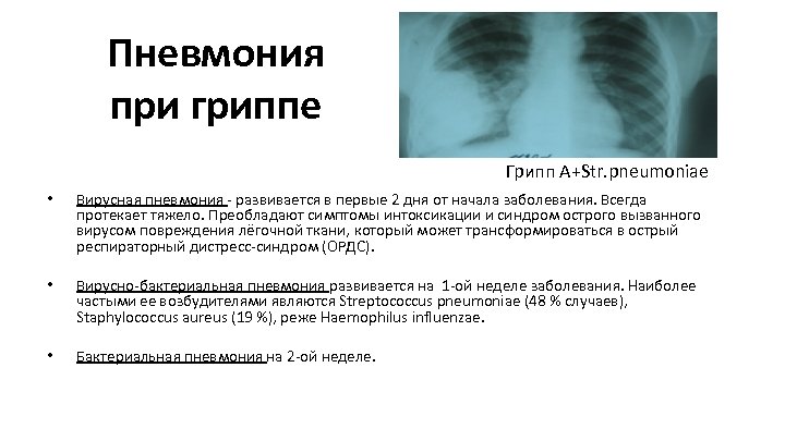 Пневмония при гриппе Грипп А+Str. pneumoniae • Вирусная пневмония - развивается в первые 2