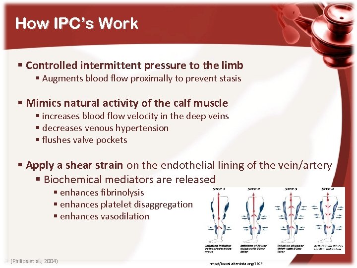 How IPC’s Work § Controlled intermittent pressure to the limb § Augments blood flow