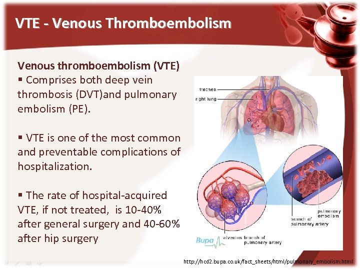 VTE - Venous Thromboembolism Venous thromboembolism (VTE) § Comprises both deep vein thrombosis (DVT)and
