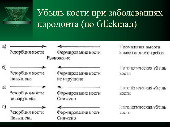 Убыль кости при заболеваниях пародонта (по Glickman) 