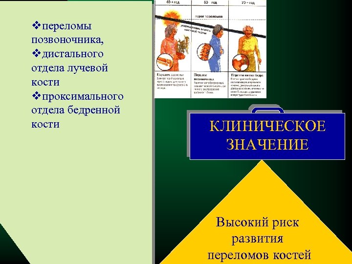 vпереломы позвоночника, vдистального отдела лучевой кости vпроксимального отдела бедренной кости КЛИНИЧЕСКОЕ ЗНАЧЕНИЕ Высокий риск