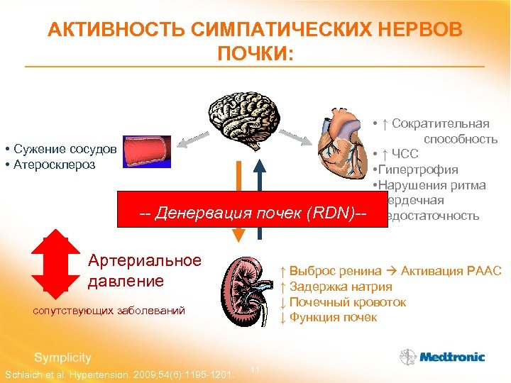 АКТИВНОСТЬ СИМПАТИЧЕСКИХ НЕРВОВ ПОЧКИ: • Сужение сосудов • Атеросклероз Эфферентны -- Денервация е нервы