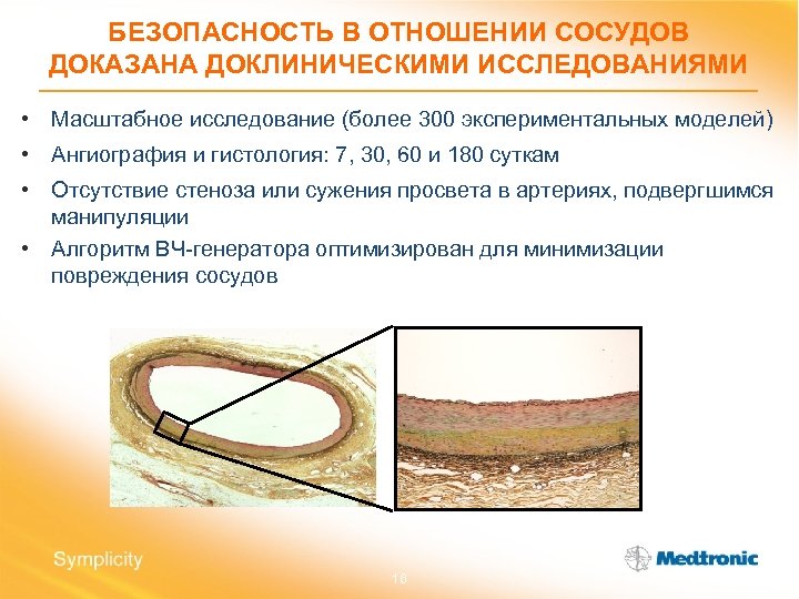 БЕЗОПАСНОСТЬ В ОТНОШЕНИИ СОСУДОВ ДОКАЗАНА ДОКЛИНИЧЕСКИМИ ИССЛЕДОВАНИЯМИ • Масштабное исследование (более 300 экспериментальных моделей)
