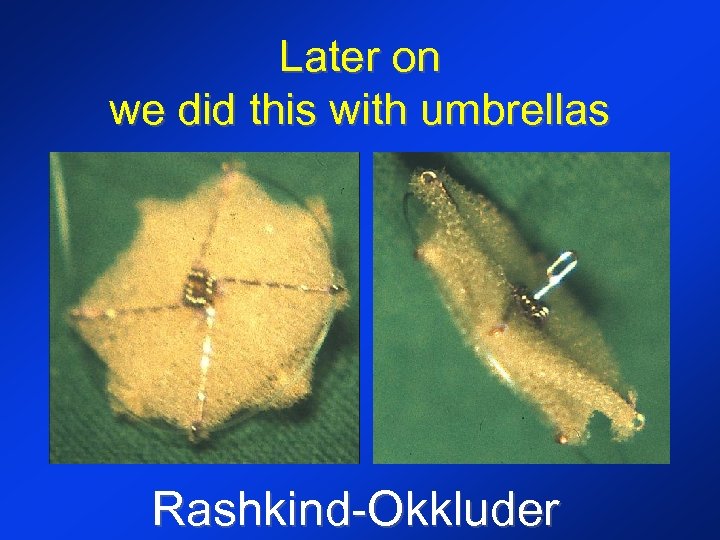 Later on we did this with umbrellas Rashkind-Okkluder 