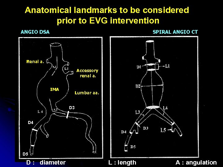 Anatomical landmarks to be considered prior to EVG intervention ANGIO DSA SPIRAL ANGIO CT