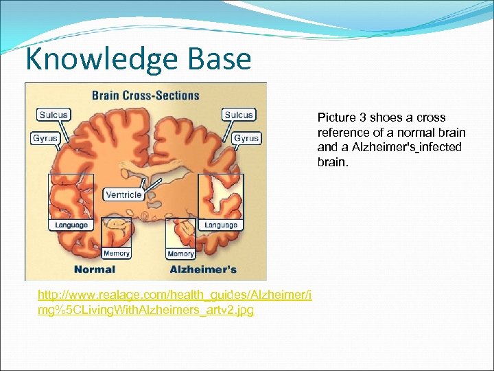 Knowledge Base Picture 3 shoes a cross reference of a normal brain and a
