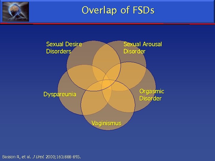 Overlap of FSDs Sexual Desire Disorders Sexual Arousal Disorder Orgasmic Disorder Dyspareunia Vaginismus Basson