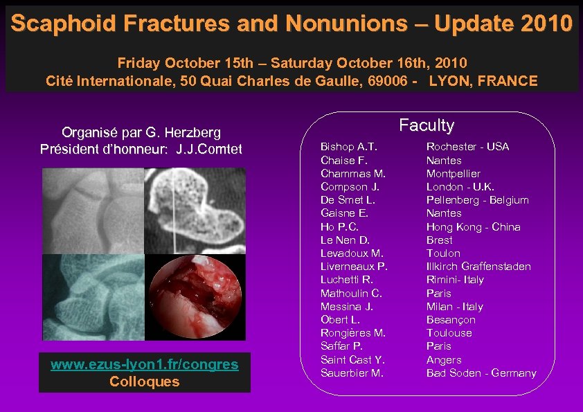 Scaphoid Fractures and Nonunions – Update 2010 Friday October 15 th – Saturday October