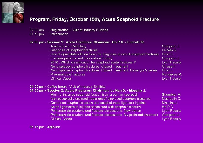 Program, Friday, October 15 th, Acute Scaphoid Fracture 12 00 am 01 50 pm