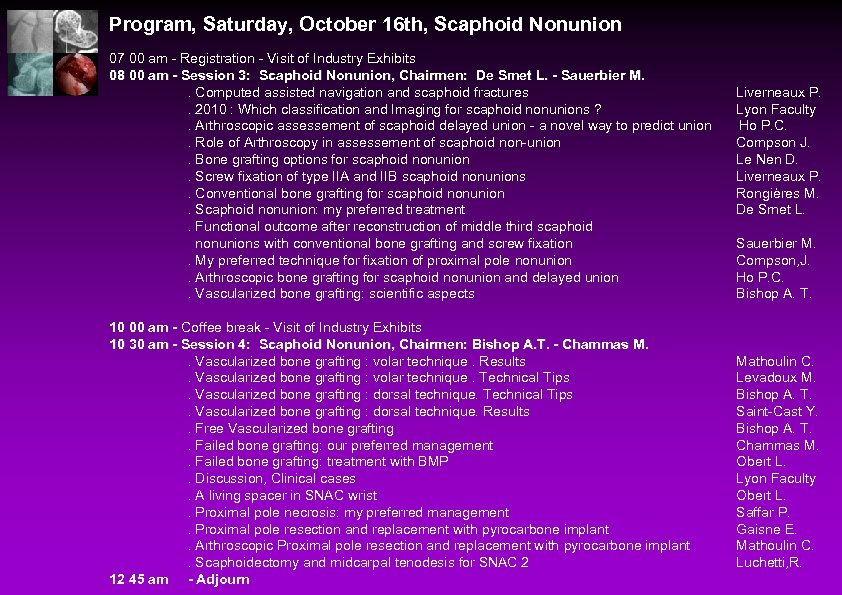 Program, Saturday, October 16 th, Scaphoid Nonunion 07 00 am - Registration - Visit