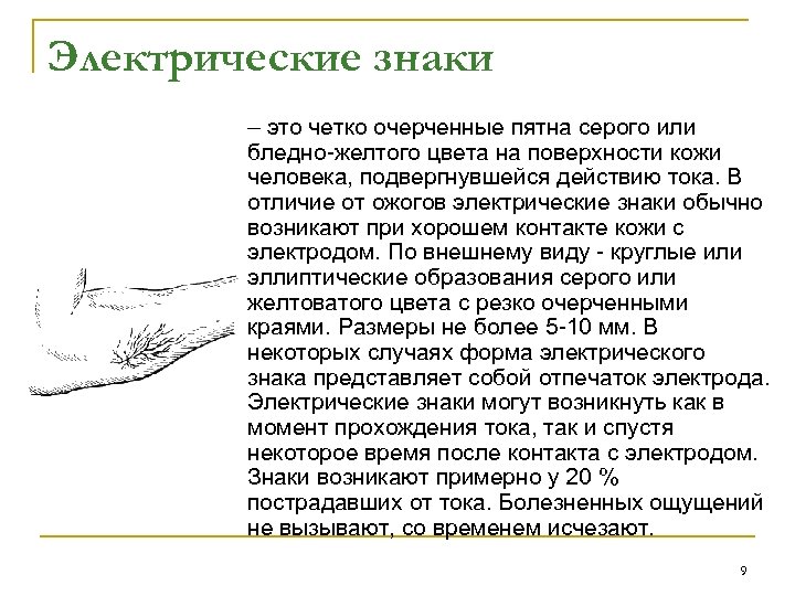 Электрические знаки – это четко очерченные пятна серого или бледно-желтого цвета на поверхности кожи