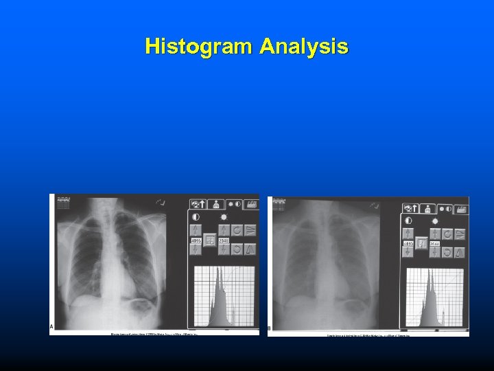 Histogram Analysis 