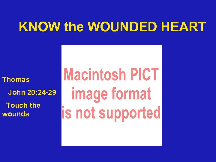 KNOW the WOUNDED HEART Thomas John 20: 24 -29 Touch the wounds 