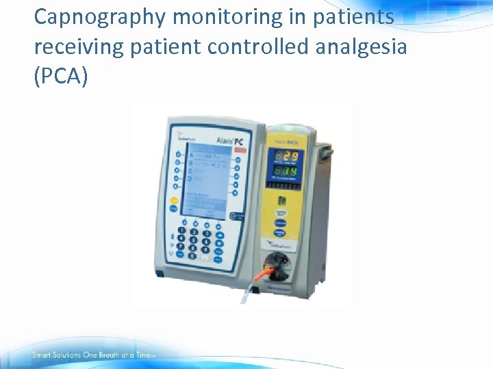 Capnography monitoring in patients receiving patient controlled analgesia (PCA) 